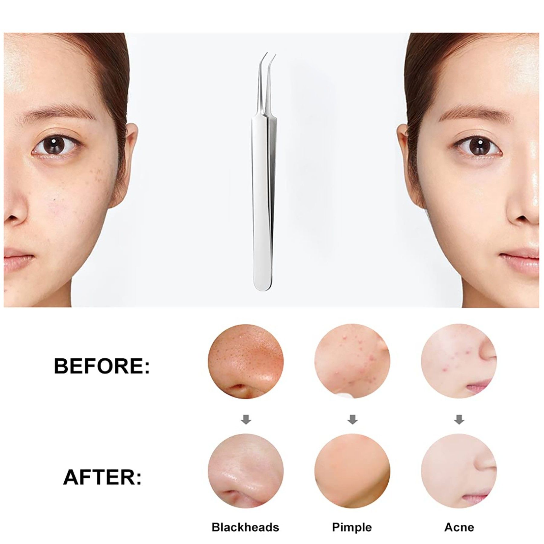 Pimple Popper Oblique Tweezer - Image 2